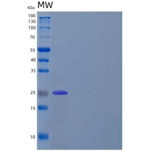 Recombinant Human Linker for Activation of T-Cells Family Member 2/LAT2 Protein(C-6His)