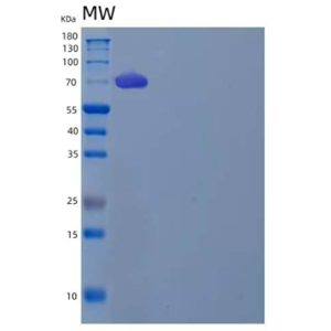 Recombinant Human Leukotriene A-4 Hydrolase/LTA4H Protein(C-6His)