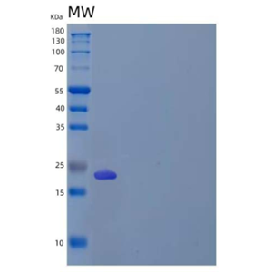 Recombinant Human Butyrophilin 3A2/BTN3A2 Protein(C-6His),Recombinant Human Butyrophilin 3A2/BTN3A2 Protein(C-6His)