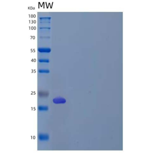 Recombinant Human Regenerating Islet-Derived Protein 3-γ/Reg3γ/REG3G Protein(C-6His)