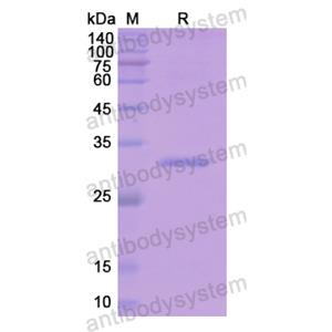 Recombinant Human APOA1, N-His