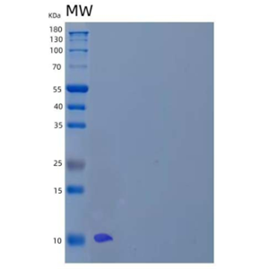 Recombinant Human Lymphocyte Antigen 6H/LY6H Protein(C-6His)