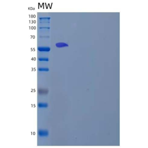 Recombinant Human Lymphocyte Cytosolic Protein 2/LCP2 Protein(C-6His, N-T7 tag)