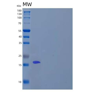 Recombinant Human Retinol-binding protein 1/RBP1 Protein