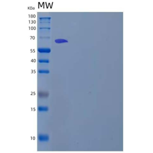 Recombinant Human Cadherin-8/CDH8 Protein(C-6His)