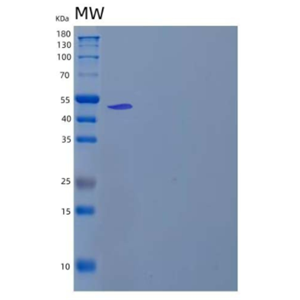 Recombinant Human Lysosomal Pro-X Carboxypeptidase/PRCP Protein(C-6His)