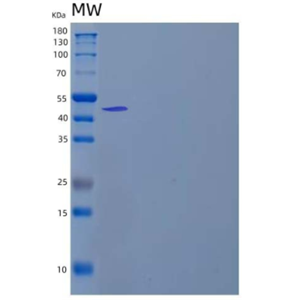 Recombinant Human Calmegin/CLGN Protein(C-6His),Recombinant Human Calmegin/CLGN Protein(C-6His)