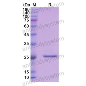 重組FGA蛋白,Recombinant Human FGA, N-His