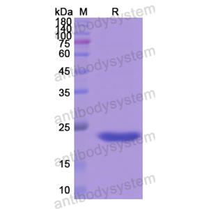 Recombinant Human MBP, N-His