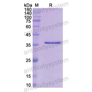 Recombinant Human CHRNA1, N-GST