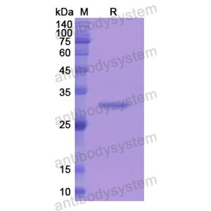 Recombinant Human CD233/SLC4A1, N-His