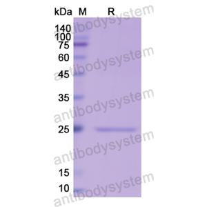 Recombinant Human CRP, N-His