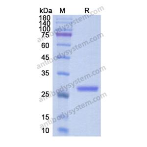 Recombinant Human APCS, C-His