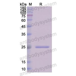 重組C1QA蛋白,Recombinant Human C1QA, N-His