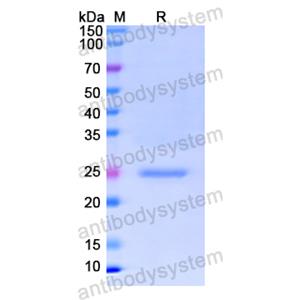 Recombinant Human C1QB, N-His