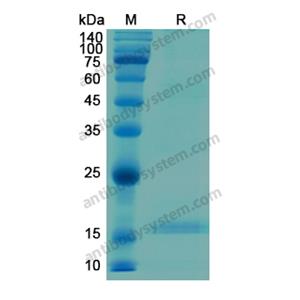 重组C1QC蛋白,Recombinant Human C1QC, N-His