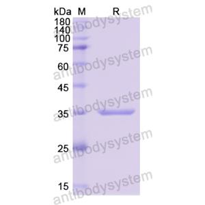 Recombinant Human LRG1, N-His