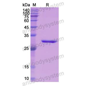 Recombinant Human AHSG, N-His