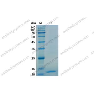 Recombinant Human CXCL10/IP-10, N-His