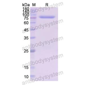 Recombinant Human LTF Protein, N-His