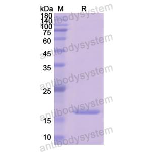 重組HPX蛋白,Recombinant Human HPX, N-His