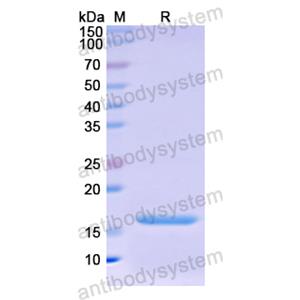 Recombinant Human Osteocalcin/BGLAP/OC, N-His