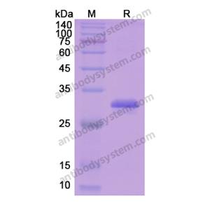 Recombinant Human ESR1/ER-alpha, N-His