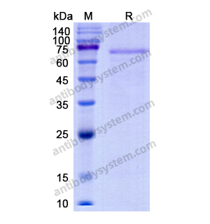 重组F11蛋白,Recombinant Human F11, C-His