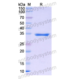 重组KLKB1蛋白,Recombinant Human KLKB1, C-His