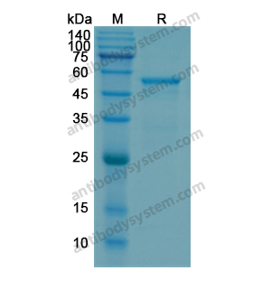 重组MMP1蛋白,Recombinant Human MMP1, N-His