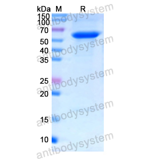 重组HMGCR蛋白,Recombinant Human HMGCR, N-SUMO