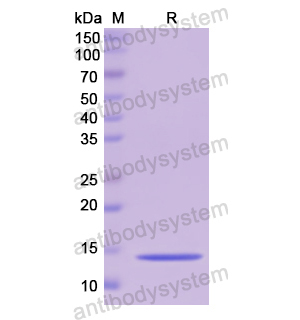 重組CSTB蛋白,Recombinant Human CSTB, N-His