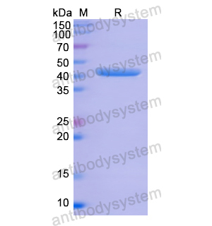 重組ANXA1蛋白,Recombinant Human ANXA1, N-His