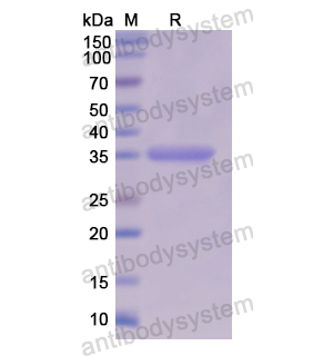 重組OAT蛋白,Recombinant Human OAT, N-His