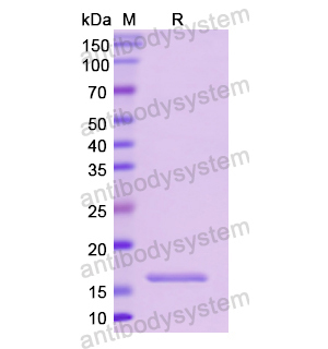 重组CD74蛋白,Recombinant Human CD74, N-His