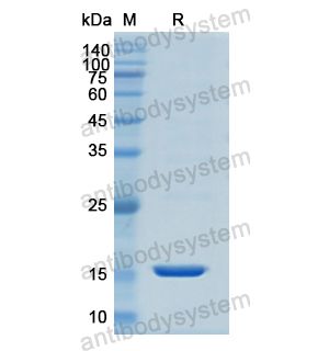 重組KRT1蛋白,Recombinant Human KRT1, N-His