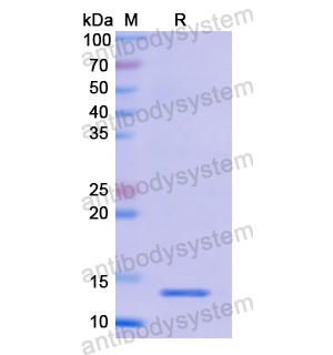 重组S100B蛋白,Recombinant Human S100B, N-His