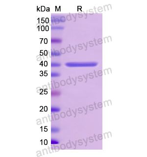 重組CD340/ERBB2蛋白,Recombinant Human CD340/ERBB2, N-His