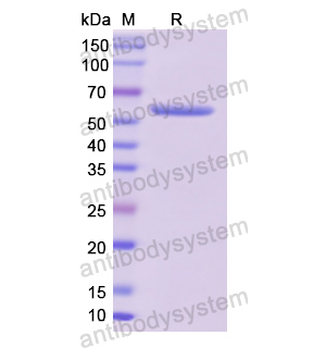 重組CAPNS1蛋白,Recombinant Human CAPNS1, N-GST