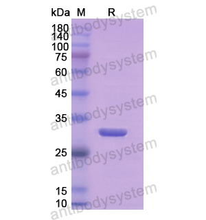 重组AMY2A蛋白,Recombinant Human AMY2A, N-His