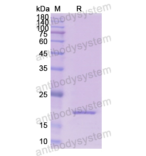 重组RPN1蛋白,Recombinant Human RPN1, N-His