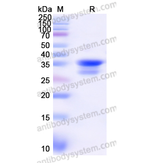 重組ATP1A1蛋白,Recombinant Human ATP1A1, N-His