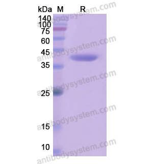 重组CYP17A1蛋白,Recombinant Human CYP17A1, N-His