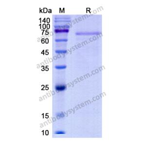 重组F11蛋白,Recombinant Human F11, C-His