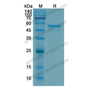 重组MMP1蛋白,Recombinant Human MMP1, N-His
