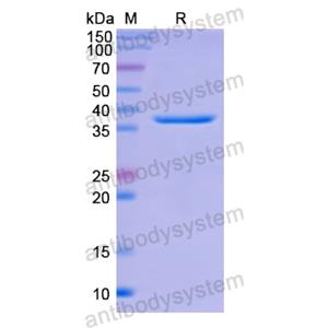 Recombinant Human C4BPA, N-His