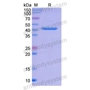 Recombinant Human VTN, N-His