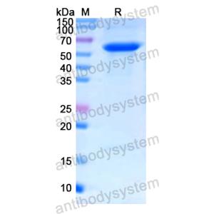 重组HMGCR蛋白,Recombinant Human HMGCR, N-SUMO