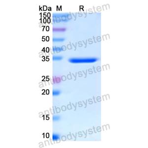 Recombinant Human RAF1, N-His