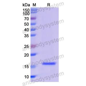 Recombinant Human PLA2G1B, N-His